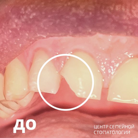 Фотография до реставрации