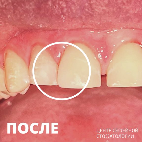 Фотография после реставрации
