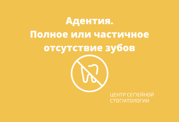 Адентия зубов - полное или частичное отсутствие зубов в зубном ряду