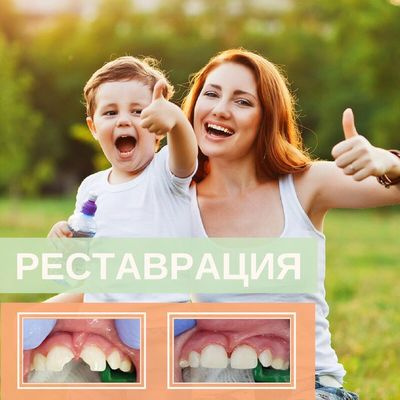 Процедура реставрации временных зубов