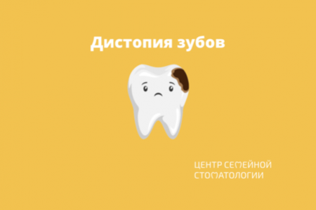 Дистопия зубов: разновидности, причины и методы лечения