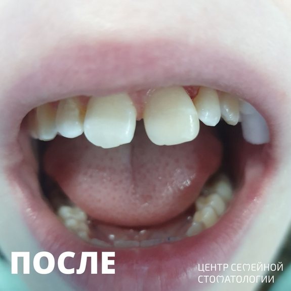 Фотография после реставрации