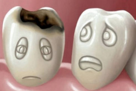 Чем опасен кариес зубов? Возможные осложнения