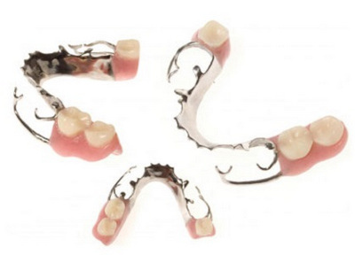 Протезирование зубов у детей: особенности, разновидности показания