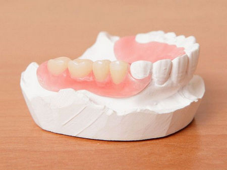Плюсы и минусы протезирования зубов