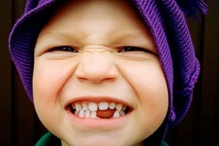 Самые распространенные травмы зубов у детей