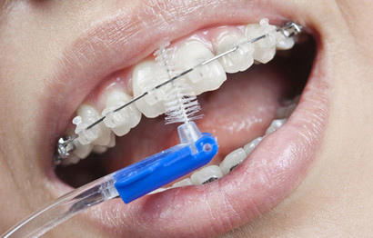 Что такое ершик для зубов и для чего он нужен?