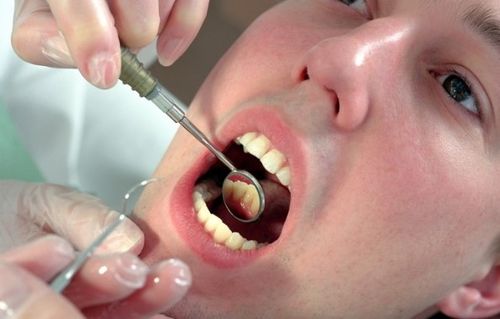 Простое удаление зуба мудрости