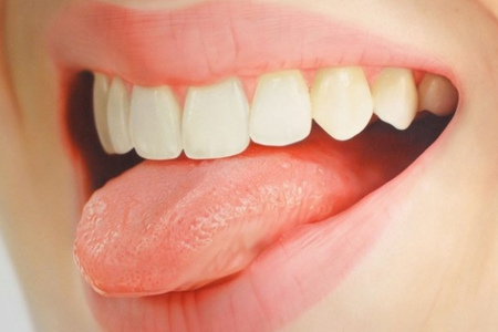 Пластика уздечки языка и губ у взрослых
