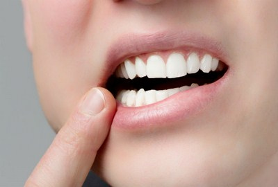 Этапы протезирования зубов металлокерамикой