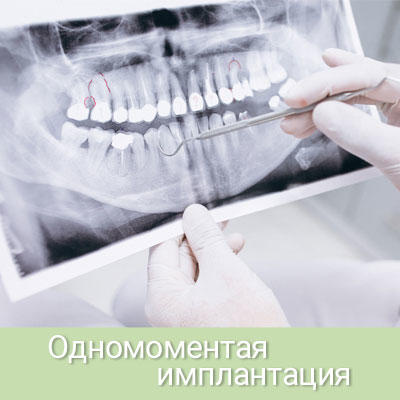 Технология одномоментной имплантации