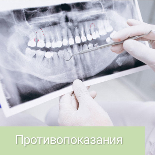 Противопоказания