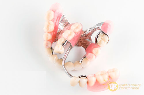 Бюгельный протез 