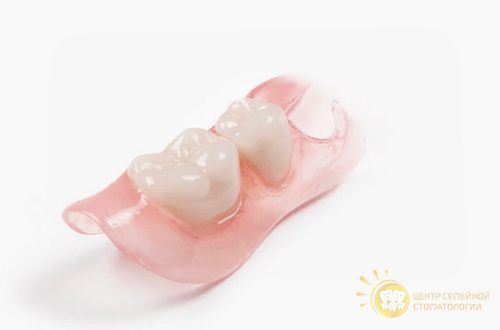 Частичный съемный иммедиат-протез “бабочка”