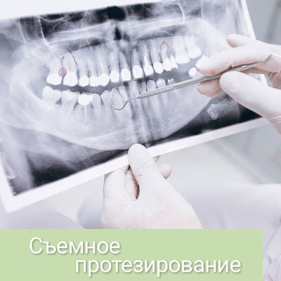 Когда требуется съемное протезирование зубов