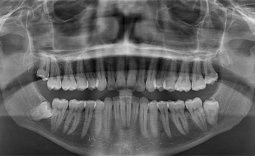 Панорамный снимок