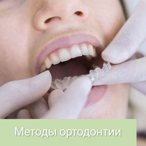 Методы лечения у врача-ортодонта