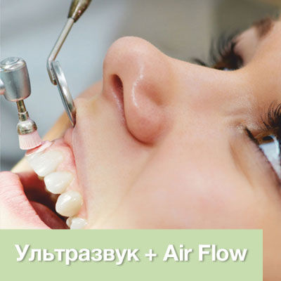 Методики профгигиены полости рта