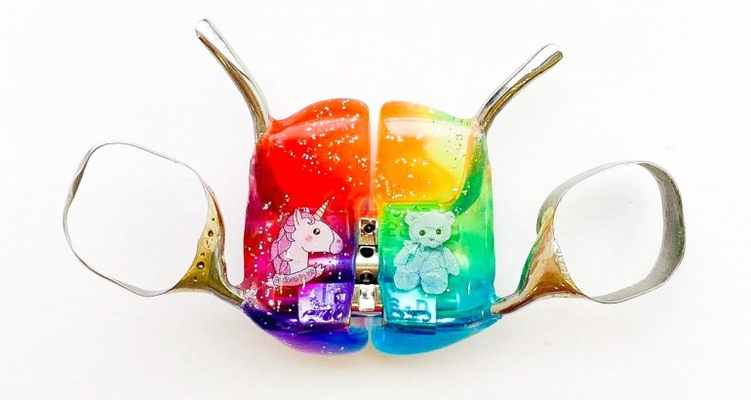 Пластинки для зубов детям: особенности и разновидности