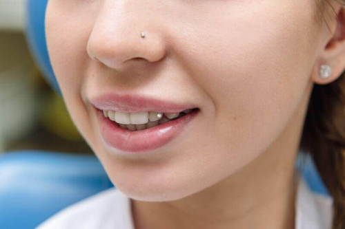 Как происходит установка скайсов