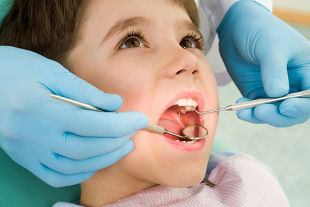 Зубной камень у детей: профилактика и удаление