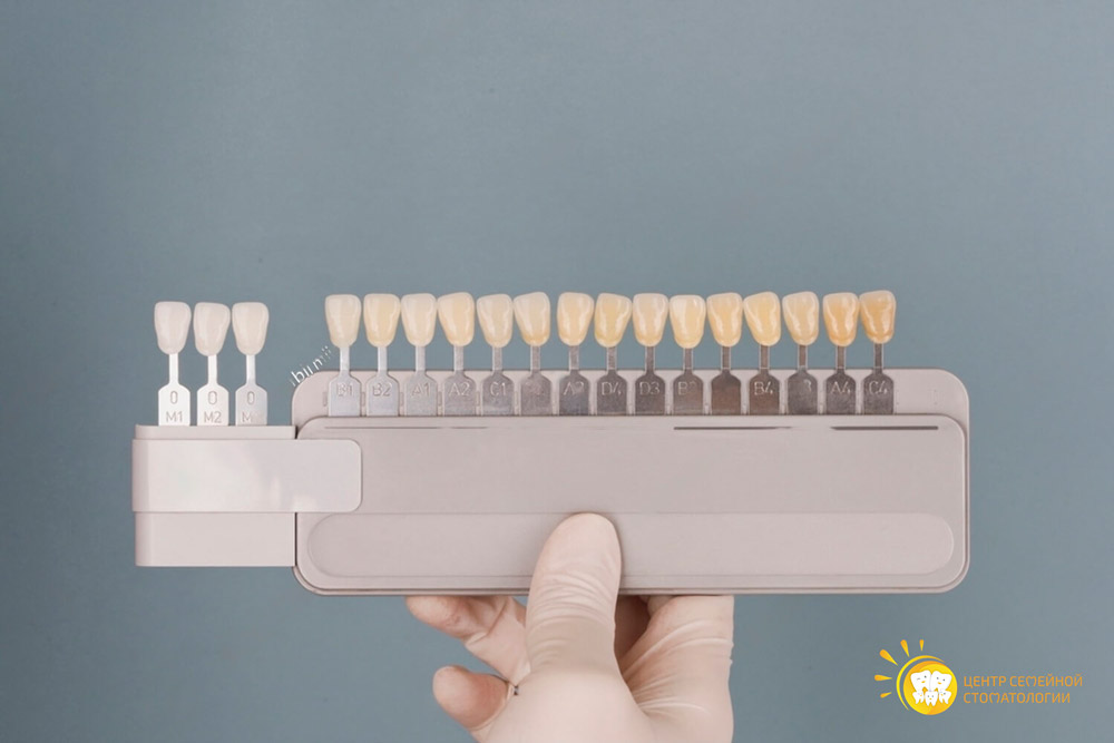 цвета керамических виниров